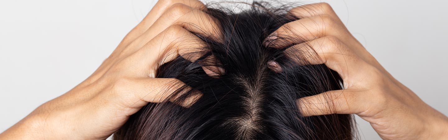 頭皮をかく女性