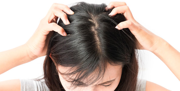 頭皮のかゆい女性