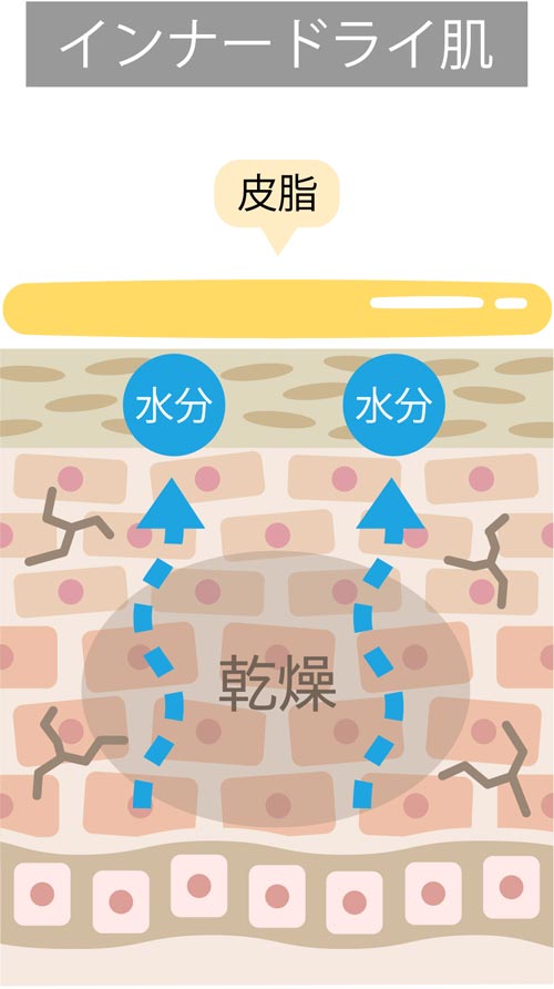 インナードライ肌の解説図