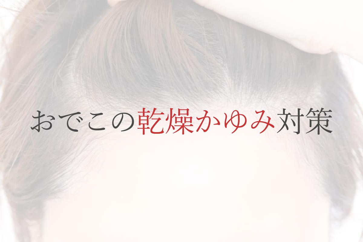 おでこの乾燥かゆみ対策