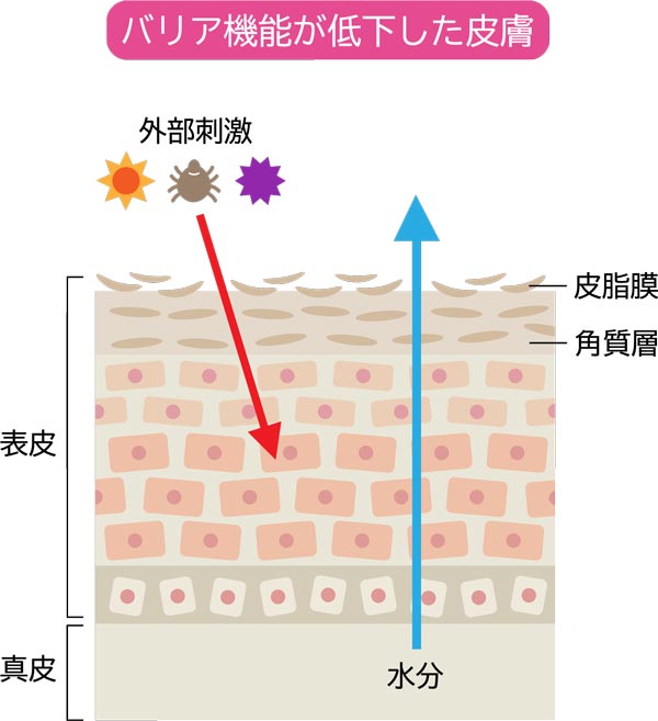 バリア機能の低下した肌の解説図