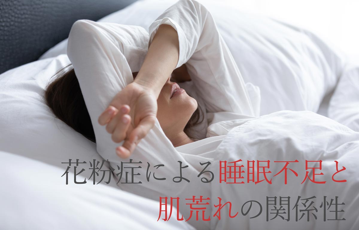 花粉症による睡眠不足と肌荒れの関係性