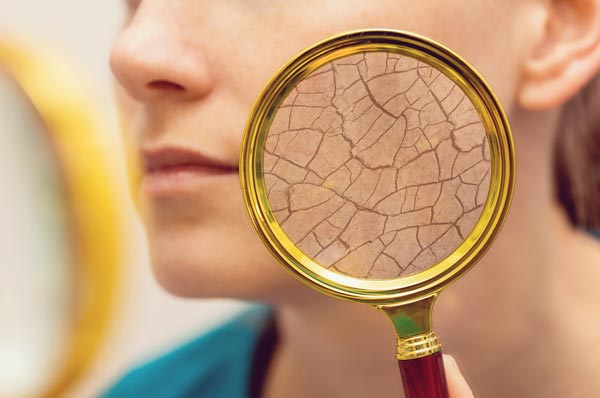 乾燥肌の女性