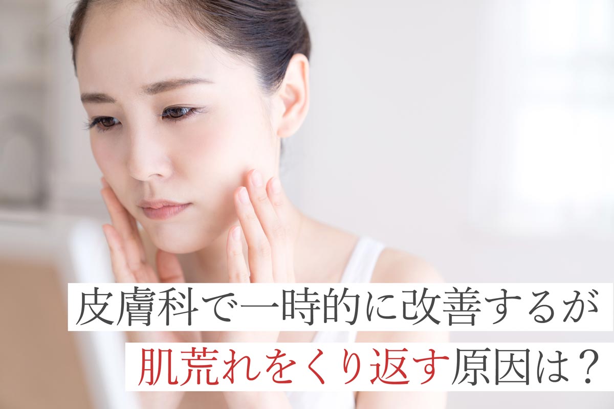 皮膚科で一時的に改善するが肌荒れをくり返す原因は？