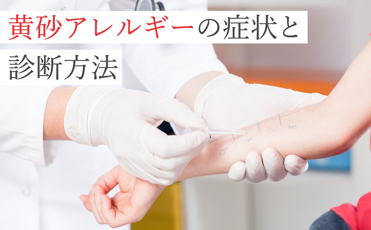 黄砂アレルギーの症状と診断方法