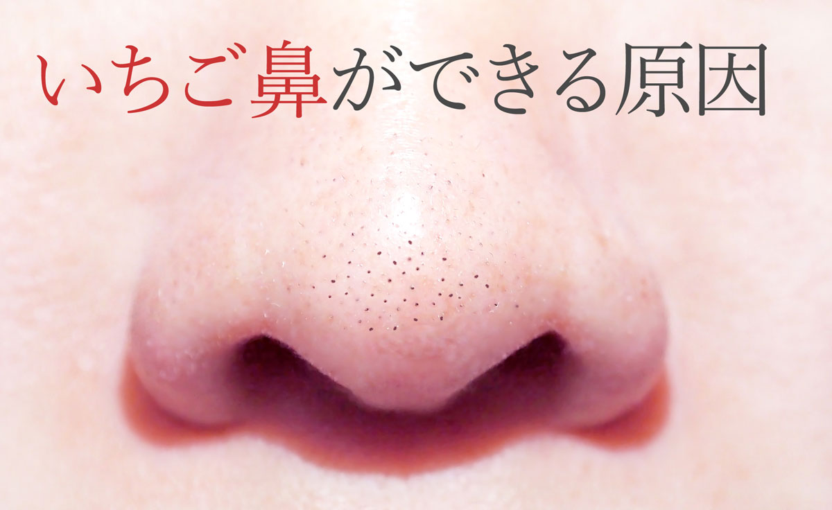 いちご鼻ができる原因