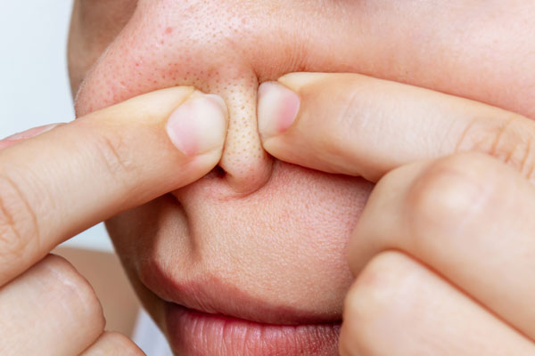 鼻の角栓を指で押し出す女性