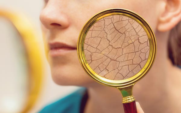 乾燥肌の女性