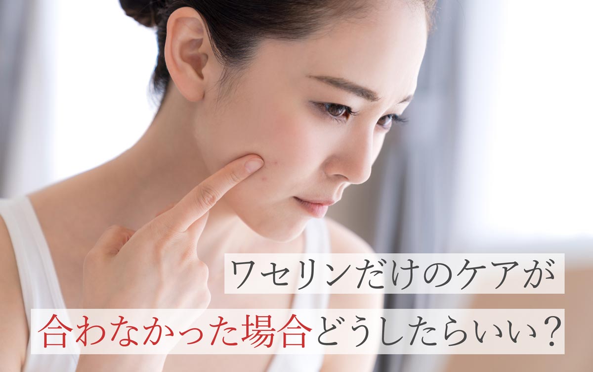 ワセリンだけのケアが合わなかった場合どうしたらいい？