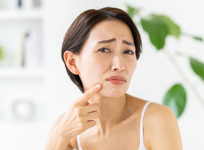 肌に悩む中年女性