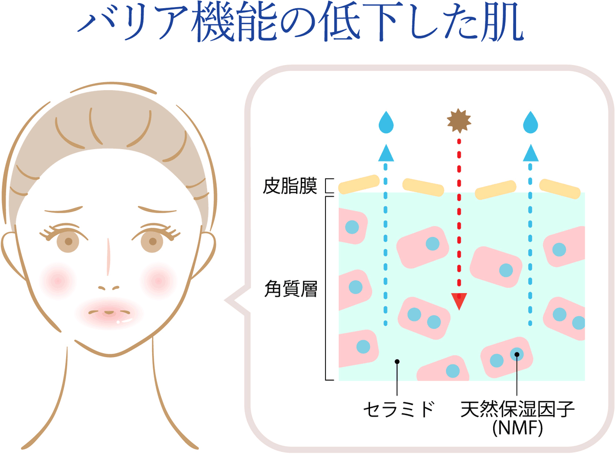 バリア機能の低下した肌の断面図