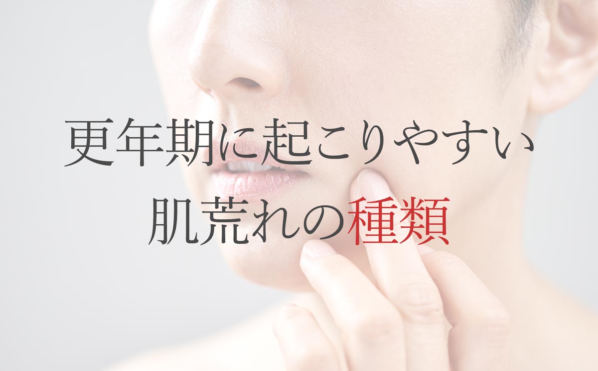 更年期に起こりやすい肌荒れの種類