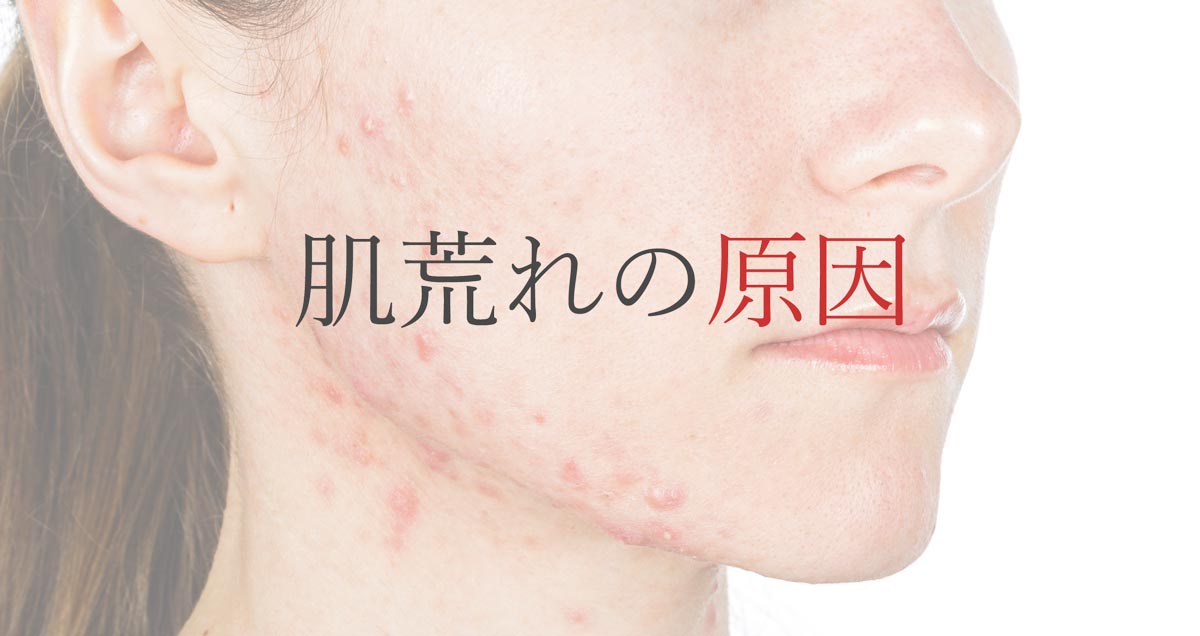 肌荒れの原因