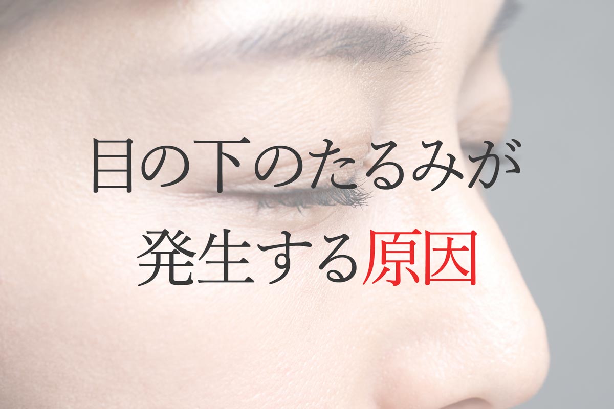目の下のたるみが発生する原因