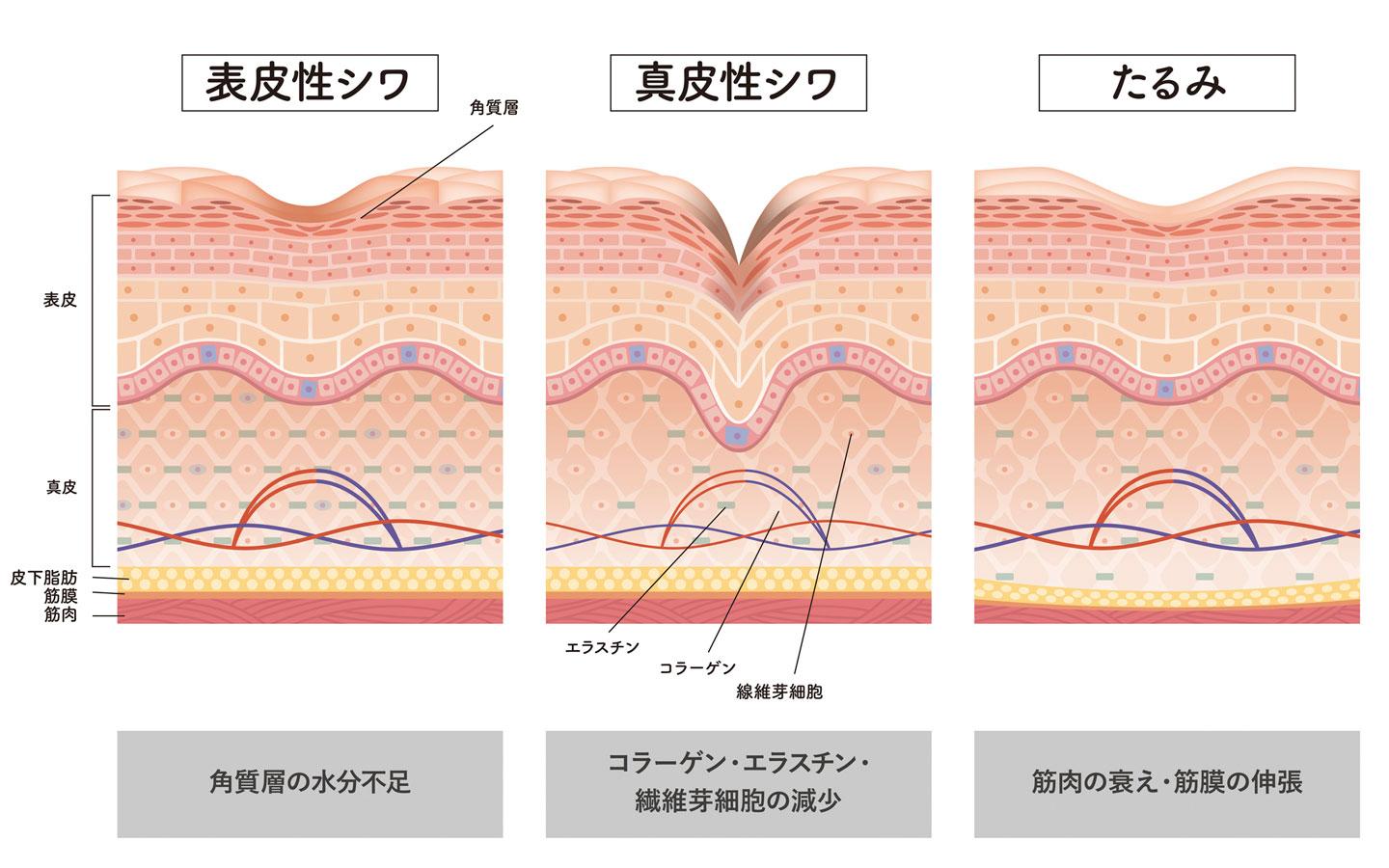 シワのある肌の断面図
