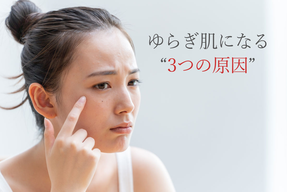 ゆらぎ肌になる3つの原因