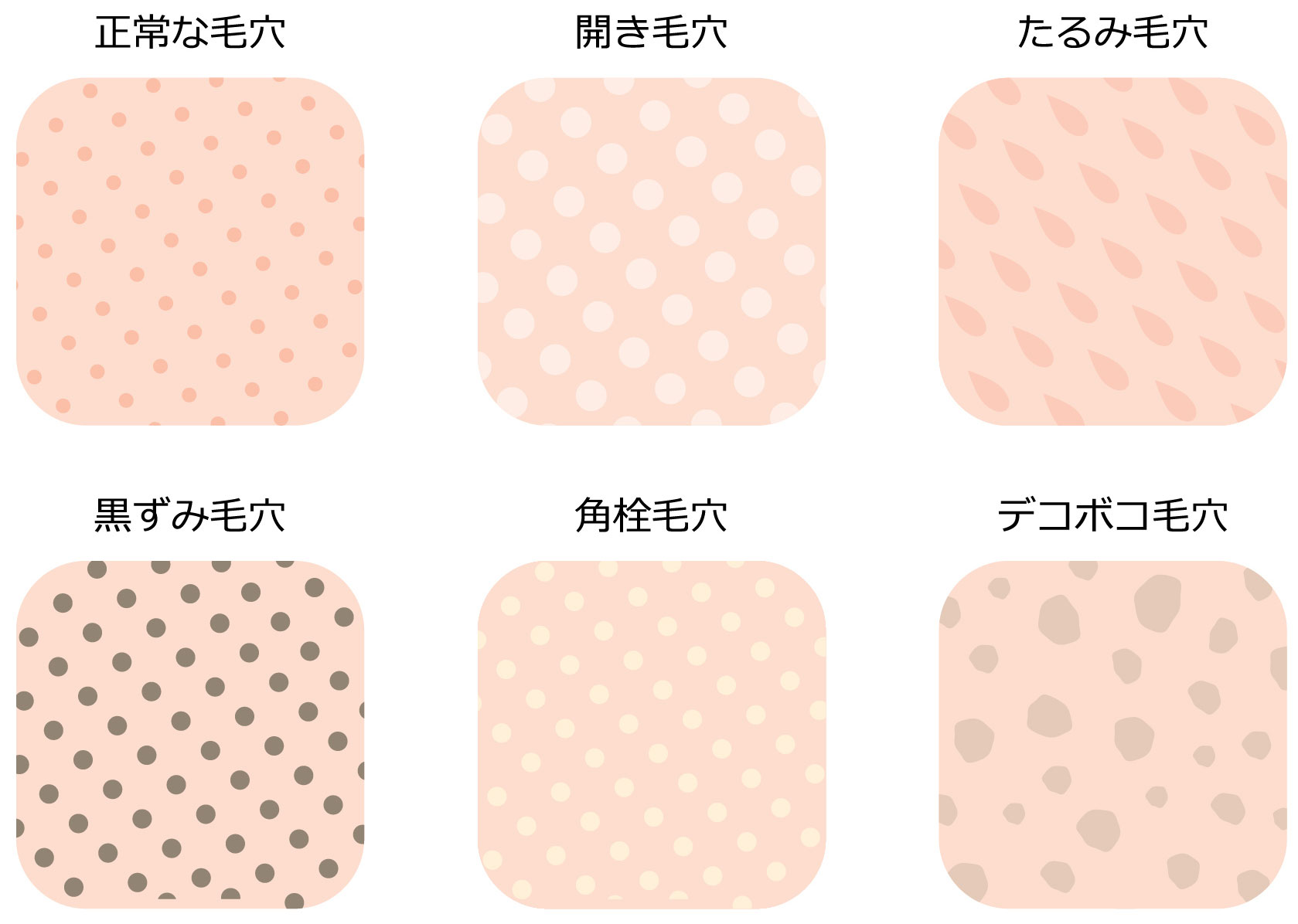 さまざまな毛穴の悩みのイラスト