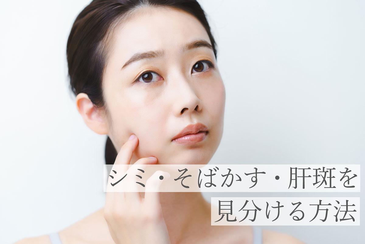 シミ・そばかす・肝斑を見分ける方法
