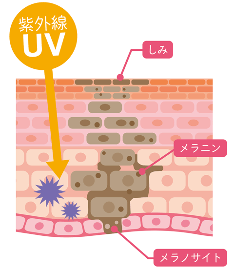 紫外線による肌への影響イラスト