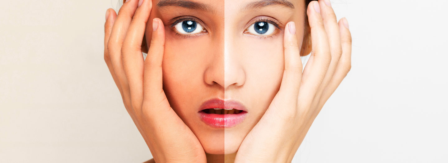 日焼け前と日焼け後の肌