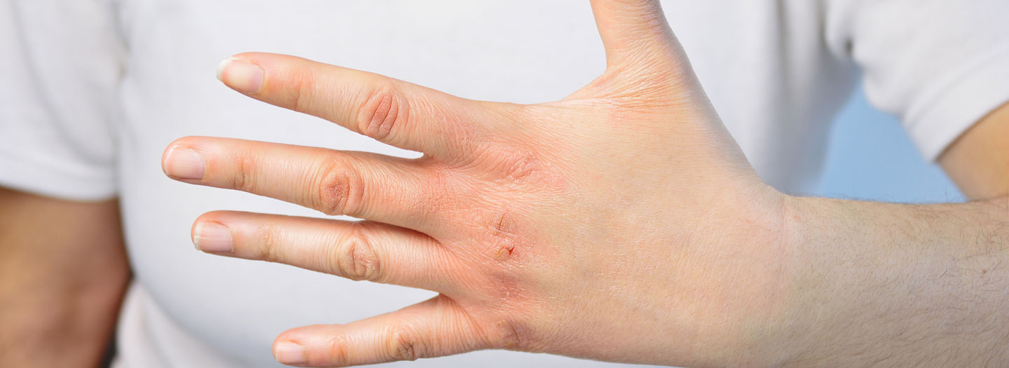 乾燥した手を見せる人