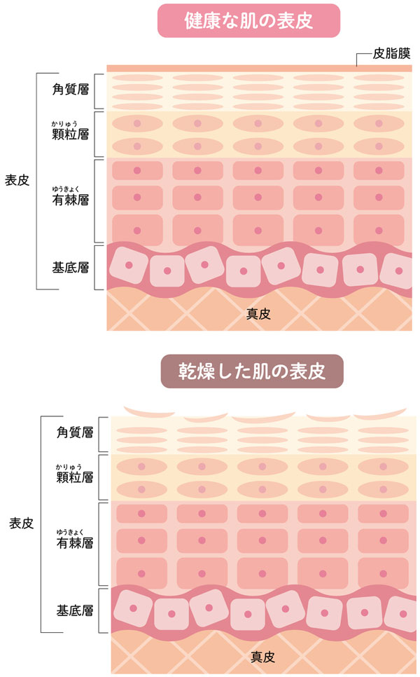 健康な皮膚と乾燥した皮膚のイラスト