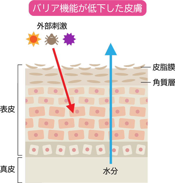 バリア機能が低下した皮膚のイラスト図