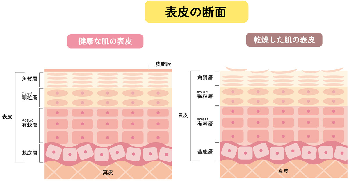 乾燥した皮膚の解説図?