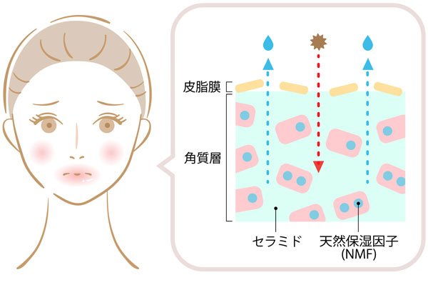 バリア機能が低下した肌の解説図