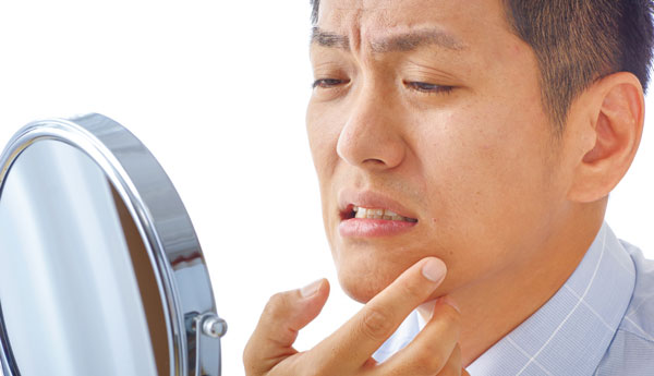 乾燥した男性の肌