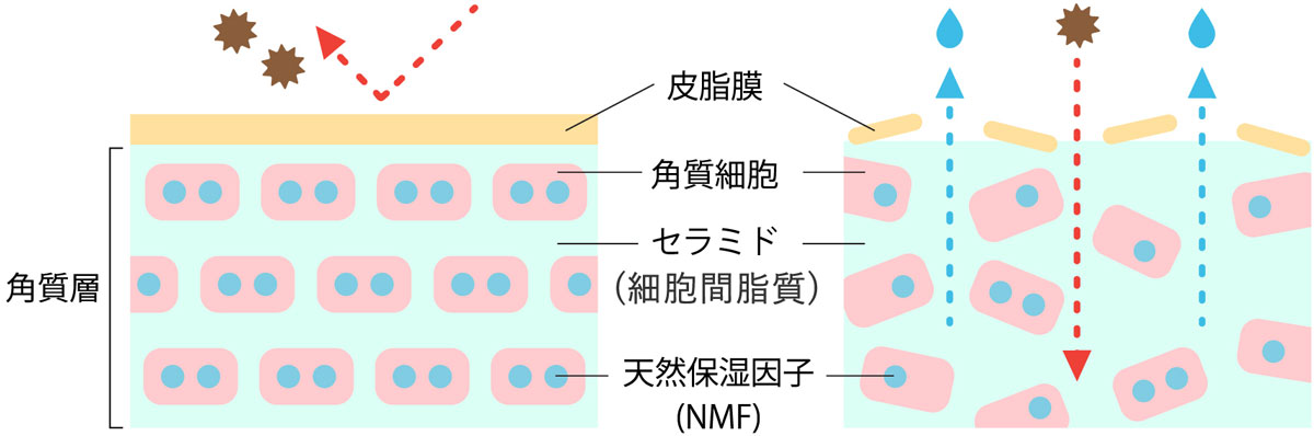 バリア機能の正常な皮膚とバリア機能が崩れた皮膚