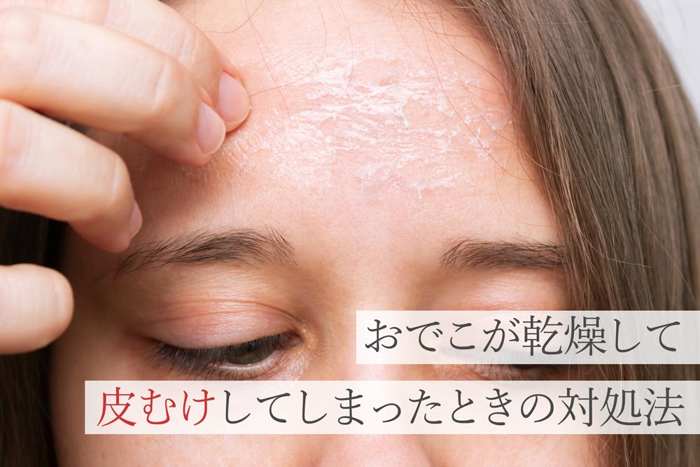 おでこが乾燥して皮むけしてしまったときの対処法